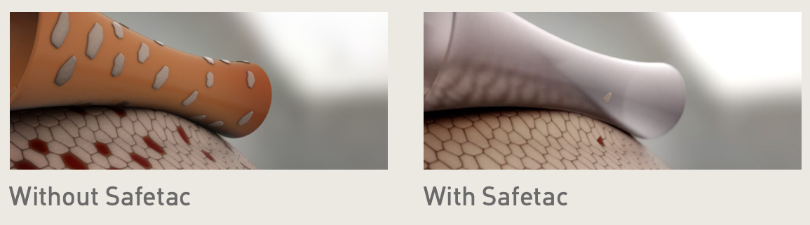 With and Without Safetec